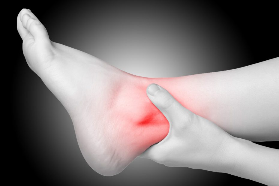 ankle sprain prevention and cure
